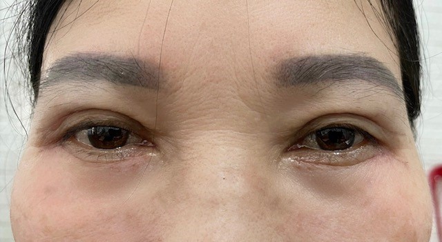http://bvthongnhatdn.vn/Images/upload/Khoa%20Mat/8.jpg